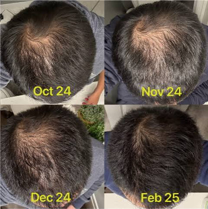 Gro Labs | Advanced Scalp & Root Care Formula