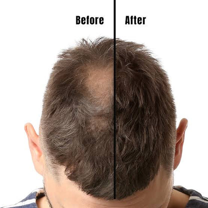 Gro Labs | Advanced Scalp & Root Care Formula
